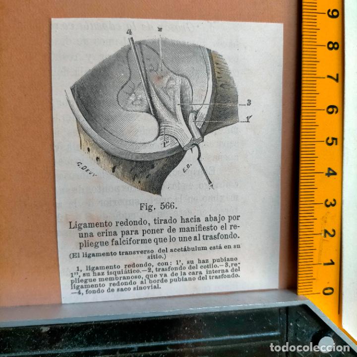 Libri antichi: antiguo grabado cuerpo humano medicina a&ntilde;o 1900 medico - PARTES ANATOMIA DISECCION VER FOTOS