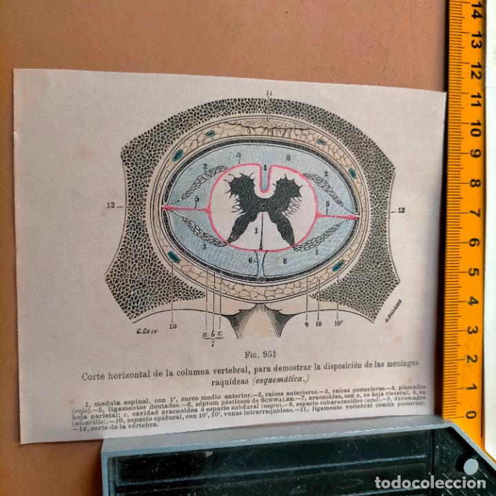 Libri antichi: antiguo grabado cuerpo humano medicina a&ntilde;o 1900 medico - PARTES ANATOMIA DISECCION VER FOTOS