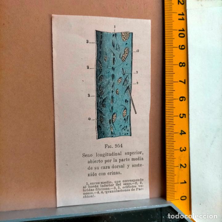 Libri antichi: antiguo grabado cuerpo humano medicina a&ntilde;o 1900 medico - PARTES ANATOMIA DISECCION VER FOTOS