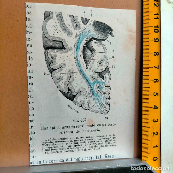 Libri antichi: antiguo grabado cuerpo humano medicina a&ntilde;o 1900 medico - PARTES ANATOMIA DISECCION VER FOTOS