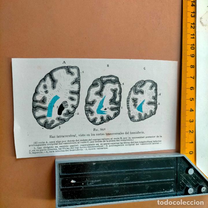 Antiquarische B&uuml;cher: antiguo grabado cuerpo humano medicina a&ntilde;o 1900 medico - PARTES ANATOMIA DISECCION VER FOTOS
