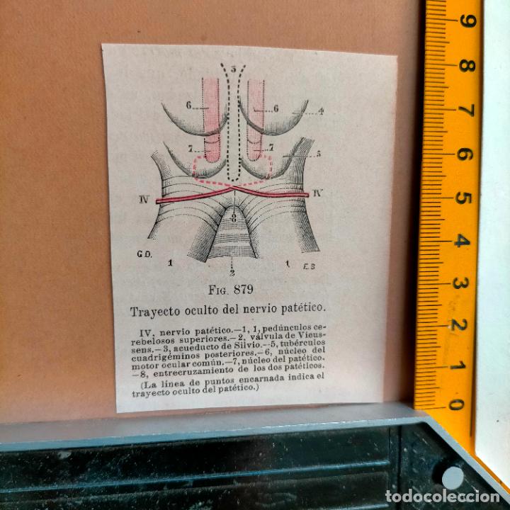 Libri antichi: antiguo grabado cuerpo humano medicina a&ntilde;o 1900 medico - PARTES ANATOMIA DISECCION VER FOTOS