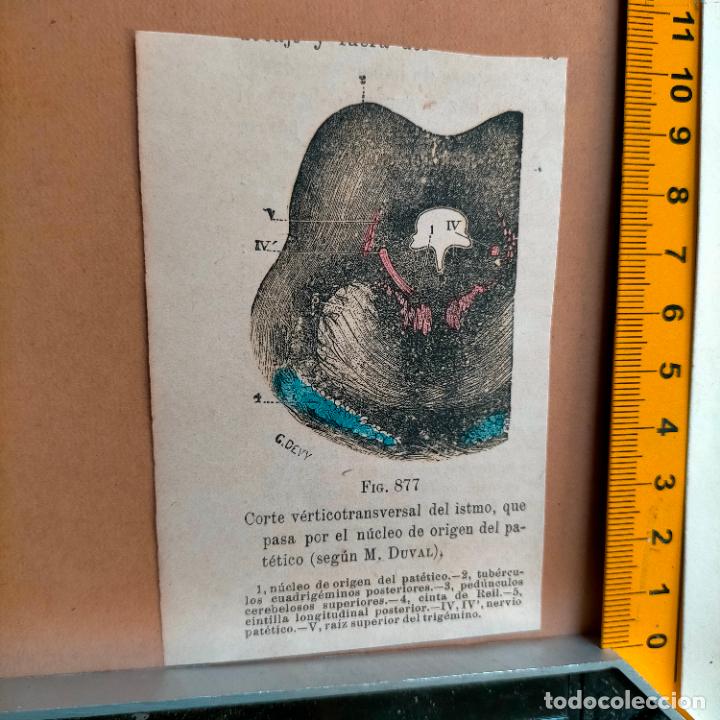 Libri antichi: antiguo grabado cuerpo humano medicina a&ntilde;o 1900 medico - PARTES ANATOMIA DISECCION VER FOTOS