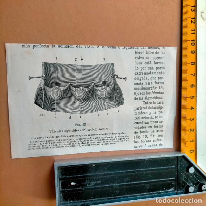 Libri antichi: antiguo grabado cuerpo humano medicina a&ntilde;o 1900 medico - PARTES ANATOMIA DISECCION VER FOTOS