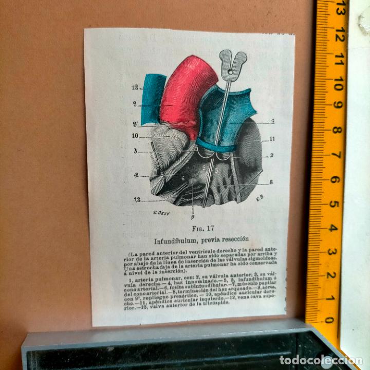 Libri antichi: antiguo grabado cuerpo humano medicina a&ntilde;o 1900 medico - PARTES ANATOMIA DISECCION VER FOTOS