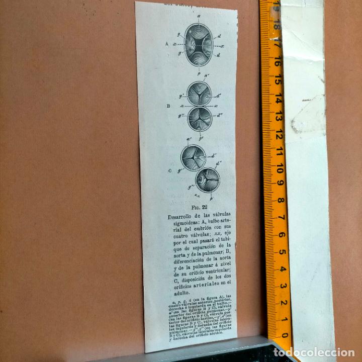 Libri antichi: antiguo grabado cuerpo humano medicina a&ntilde;o 1900 medico - PARTES ANATOMIA DISECCION VER FOTOS