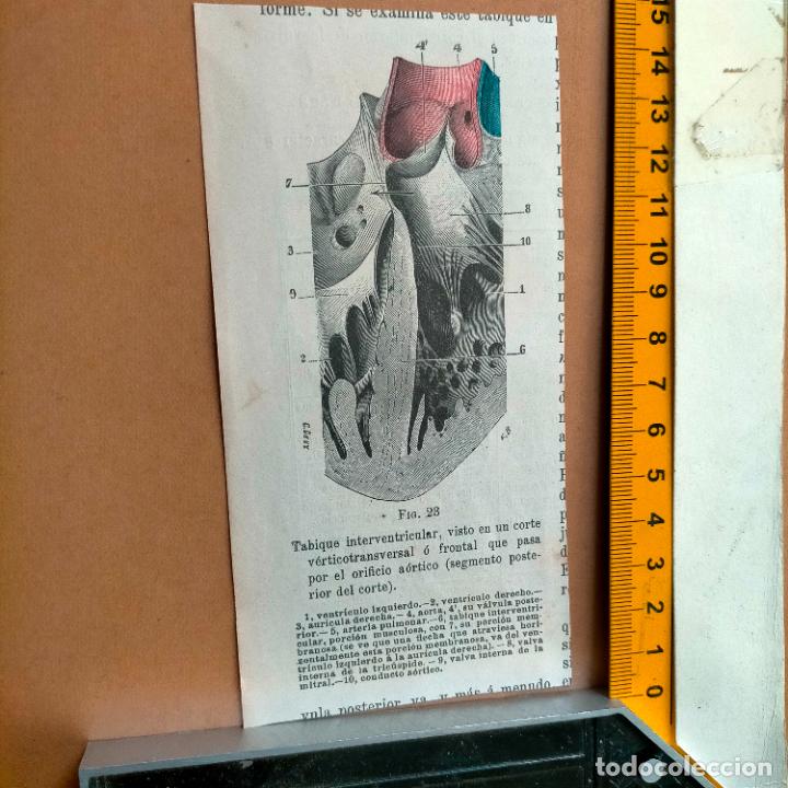 Antiquarische B&uuml;cher: antiguo grabado cuerpo humano medicina a&ntilde;o 1900 medico - PARTES ANATOMIA DISECCION VER FOTOS