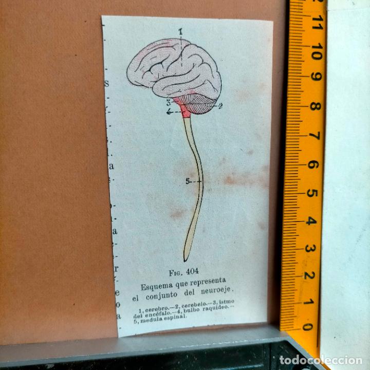 Antiquarische B&uuml;cher: antiguo grabado cuerpo humano medicina a&ntilde;o 1900 medico - PARTES ANATOMIA DISECCION VER FOTOS