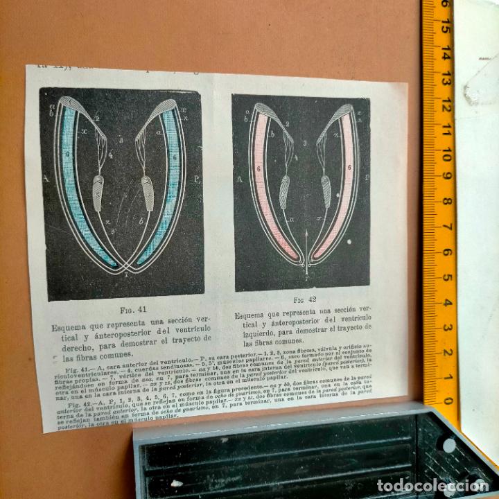 Antiquarische B&uuml;cher: antiguo grabado cuerpo humano medicina a&ntilde;o 1900 medico - PARTES ANATOMIA DISECCION VER FOTOS