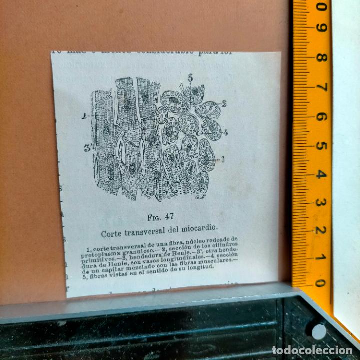 Antiquarische B&uuml;cher: antiguo grabado cuerpo humano medicina a&ntilde;o 1900 medico - PARTES ANATOMIA DISECCION VER FOTOS