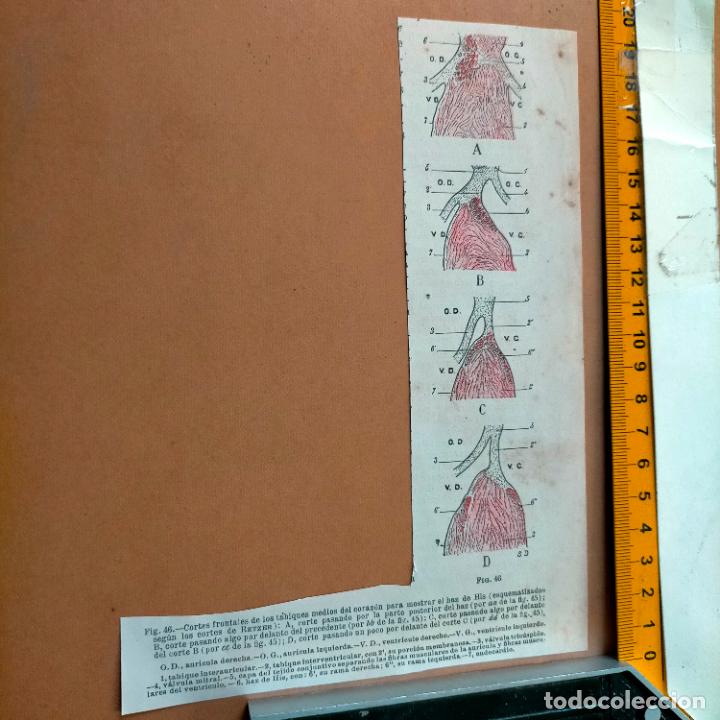 Antiquarische B&uuml;cher: antiguo grabado cuerpo humano medicina a&ntilde;o 1900 medico - PARTES ANATOMIA DISECCION VER FOTOS