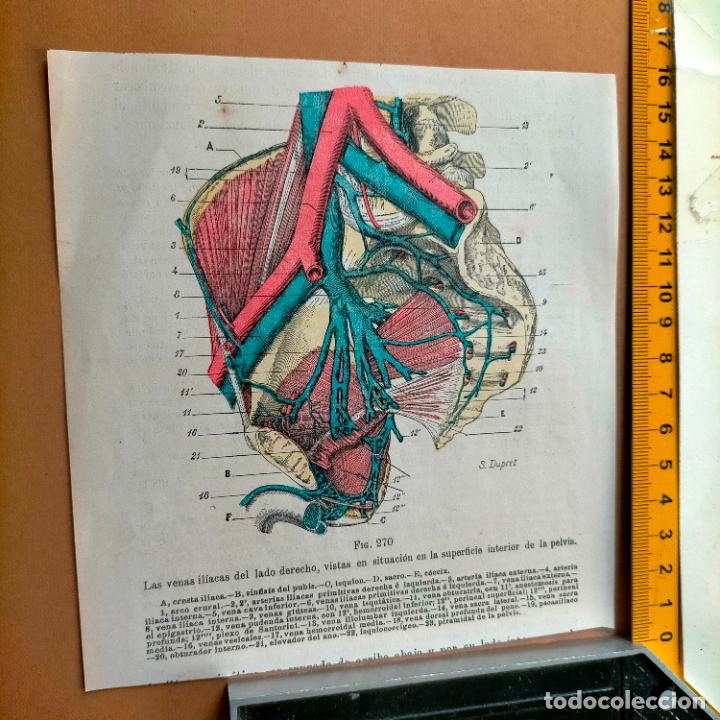 Antiquarische B&uuml;cher: antiguo grabado cuerpo humano medicina a&ntilde;o 1900 medico - PARTES ANATOMIA DISECCION VER FOTOS