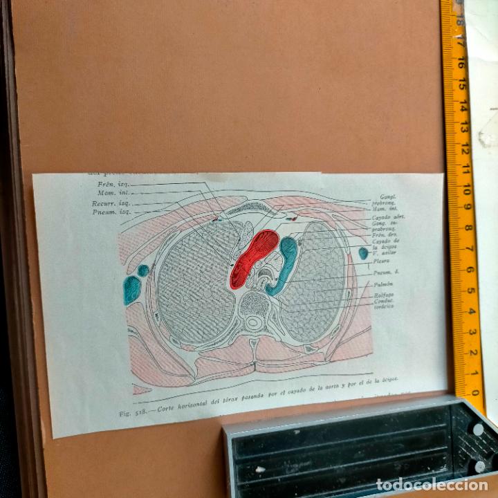 Antiquarische B&uuml;cher: antiguo grabado cuerpo humano medicina a&ntilde;o 1900 medico - PARTES ANATOMIA DISECCION VER FOTOS