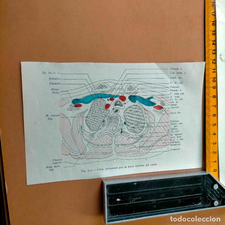 Antiquarische B&uuml;cher: antiguo grabado cuerpo humano medicina a&ntilde;o 1900 medico - PARTES ANATOMIA DISECCION VER FOTOS