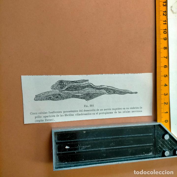 Antiquarische B&uuml;cher: antiguo grabado cuerpo humano medicina a&ntilde;o 1900 medico - PARTES ANATOMIA DISECCION VER FOTOS