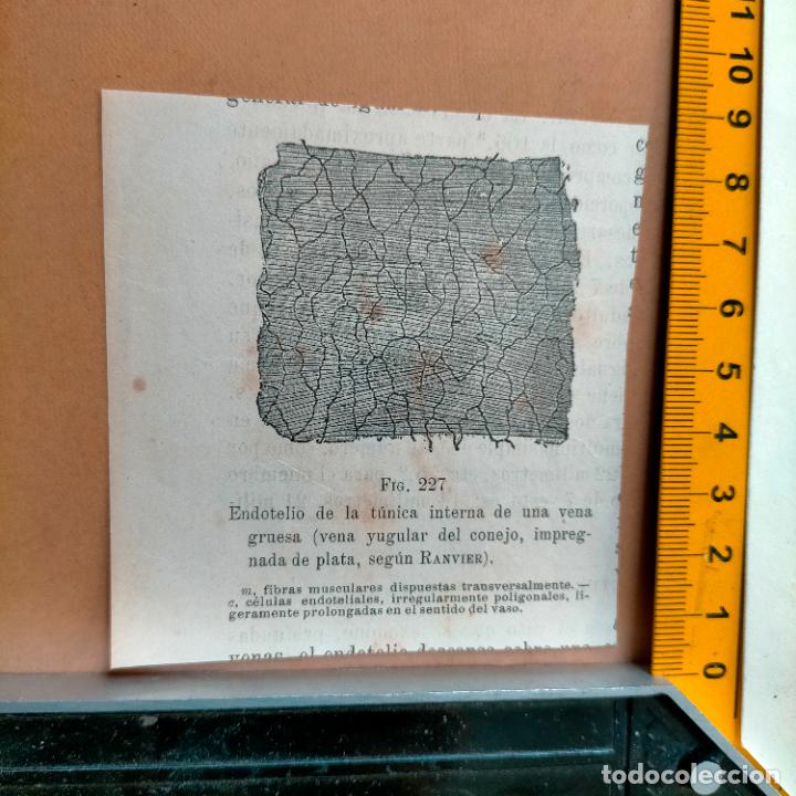Antiquarische B&uuml;cher: antiguo grabado cuerpo humano medicina a&ntilde;o 1900 medico - PARTES ANATOMIA DISECCION VER FOTOS