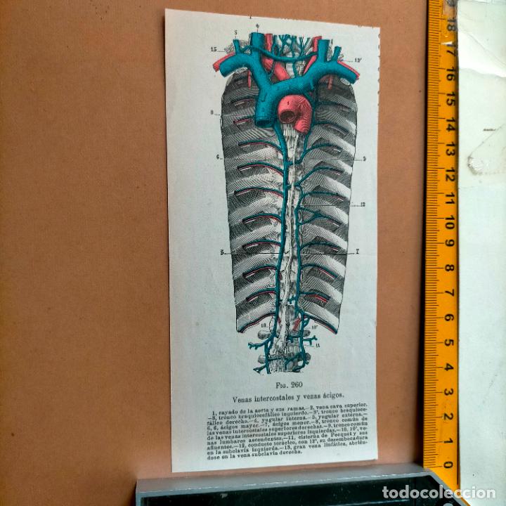 Antiquarische B&uuml;cher: antiguo grabado cuerpo humano medicina a&ntilde;o 1900 medico - PARTES ANATOMIA DISECCION VER FOTOS