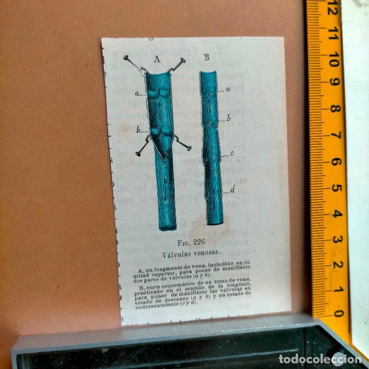 Antiquarische B&uuml;cher: antiguo grabado cuerpo humano medicina a&ntilde;o 1900 medico - PARTES ANATOMIA DISECCION VER FOTOS