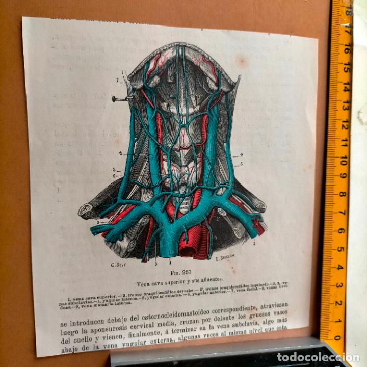 Antiquarische B&uuml;cher: antiguo grabado cuerpo humano medicina a&ntilde;o 1900 medico - PARTES ANATOMIA DISECCION VER FOTOS