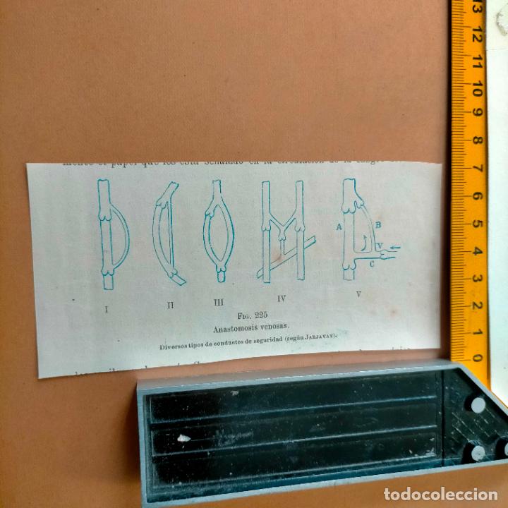Libri antichi: antiguo grabado cuerpo humano medicina a&ntilde;o 1900 medico - PARTES ANATOMIA DISECCION VER FOTOS