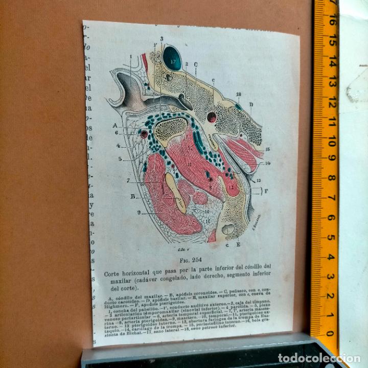 Libri antichi: antiguo grabado cuerpo humano medicina a&ntilde;o 1900 medico - PARTES ANATOMIA DISECCION VER FOTOS