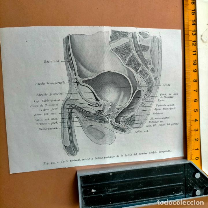 Libri antichi: antiguo grabado cuerpo humano medicina a&ntilde;o 1900 medico - PARTES ANATOMIA DISECCION VER FOTOS