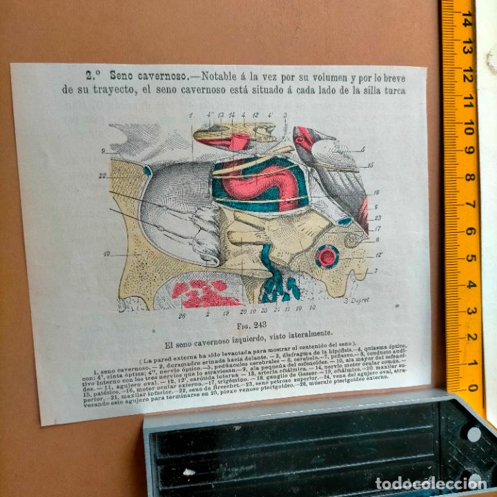 Libri antichi: antiguo grabado cuerpo humano medicina a&ntilde;o 1900 medico - PARTES ANATOMIA DISECCION VER FOTOS