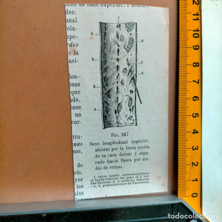 Libri antichi: antiguo grabado cuerpo humano medicina a&ntilde;o 1900 medico - PARTES ANATOMIA DISECCION VER FOTOS
