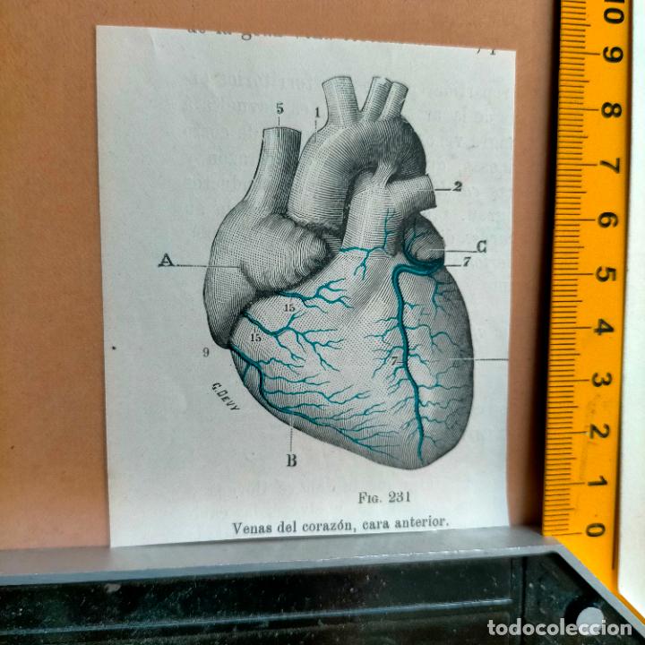 Libri antichi: antiguo grabado cuerpo humano medicina a&ntilde;o 1900 medico - PARTES ANATOMIA DISECCION VER FOTOS