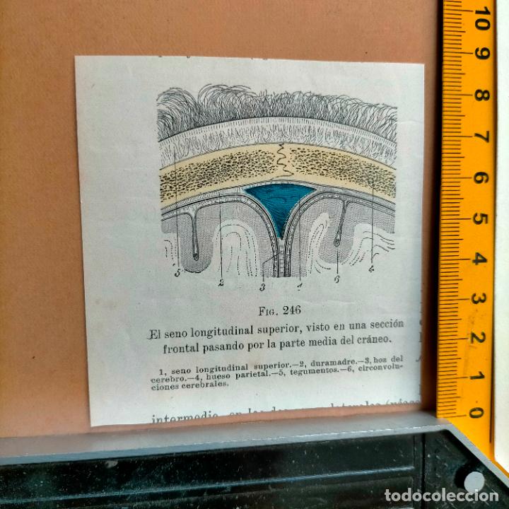 Libri antichi: antiguo grabado cuerpo humano medicina a&ntilde;o 1900 medico - PARTES ANATOMIA DISECCION VER FOTOS