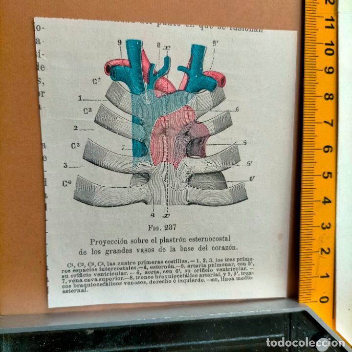 Libri antichi: antiguo grabado cuerpo humano medicina a&ntilde;o 1900 medico - PARTES ANATOMIA DISECCION VER FOTOS