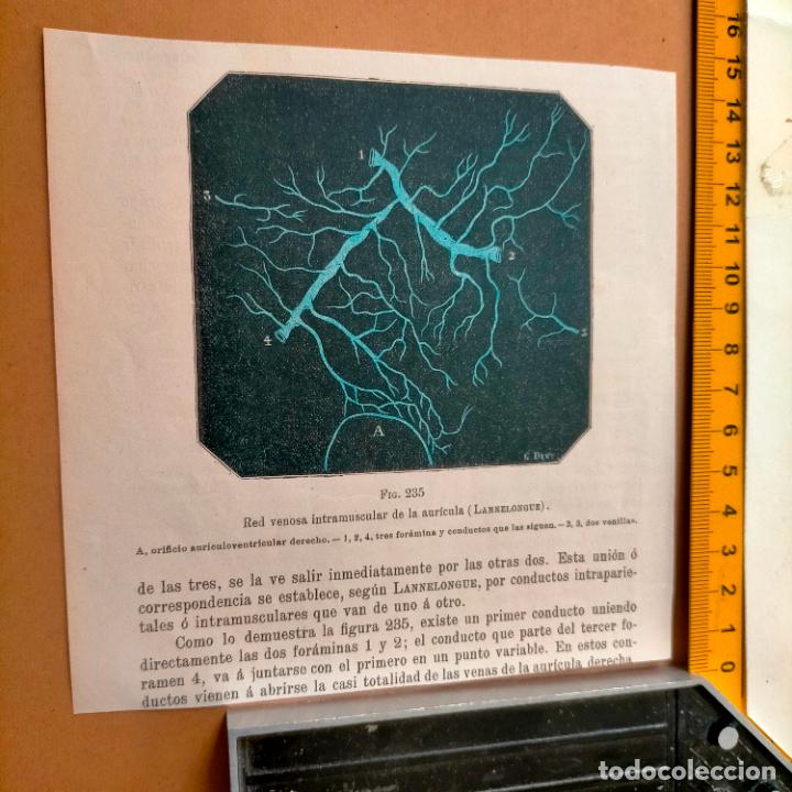 Libri antichi: antiguo grabado cuerpo humano medicina a&ntilde;o 1900 medico - PARTES ANATOMIA DISECCION VER FOTOS