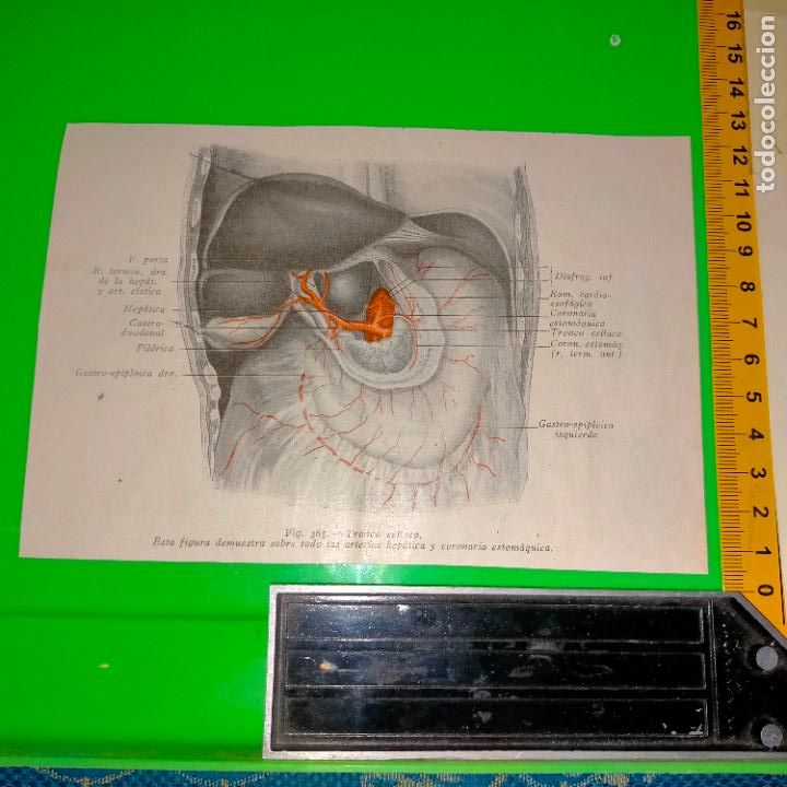 Antiquarische B&uuml;cher: antiguo grabado cuerpo humano medicina a&ntilde;o 1900 medico - PARTES ANATOMIA DISECCION VER FOTOS