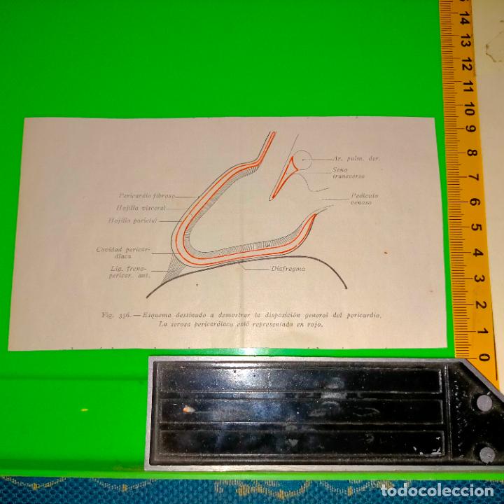 Antiquarische B&uuml;cher: antiguo grabado cuerpo humano medicina a&ntilde;o 1900 medico - PARTES ANATOMIA DISECCION VER FOTOS