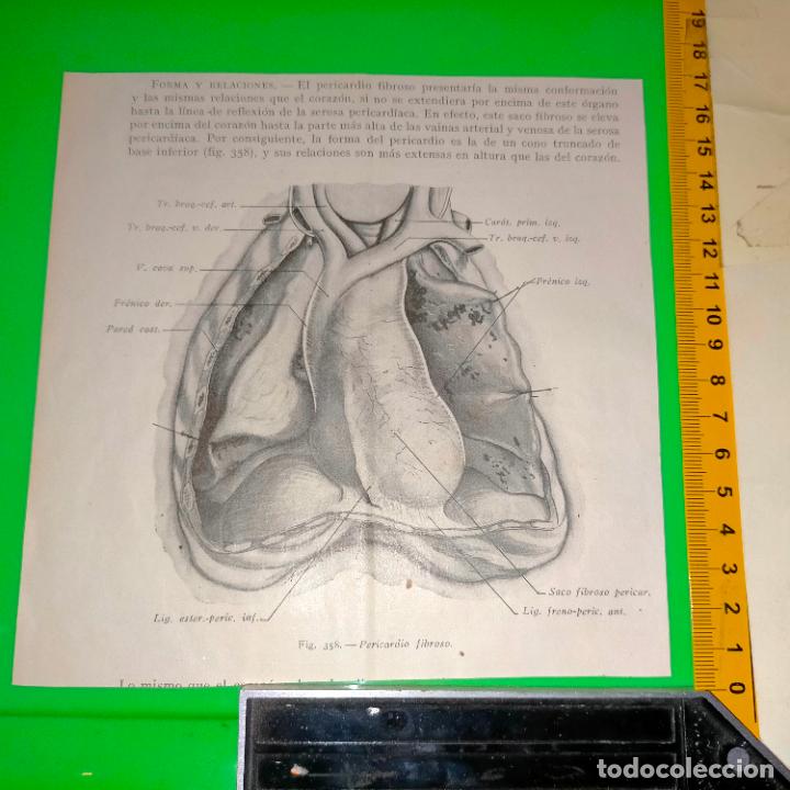 Antiquarische B&uuml;cher: antiguo grabado cuerpo humano medicina a&ntilde;o 1900 medico - PARTES ANATOMIA DISECCION VER FOTOS