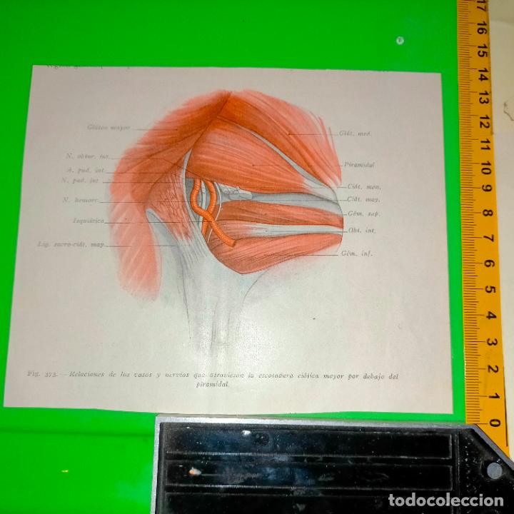 Antiquarische B&uuml;cher: antiguo grabado cuerpo humano medicina a&ntilde;o 1900 medico - PARTES ANATOMIA DISECCION VER FOTOS
