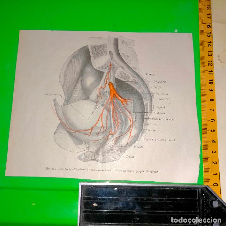 Antiquarische B&uuml;cher: antiguo grabado cuerpo humano medicina a&ntilde;o 1900 medico - PARTES ANATOMIA DISECCION VER FOTOS