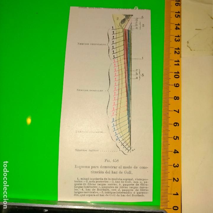 Antiquarische B&uuml;cher: antiguo grabado cuerpo humano medicina a&ntilde;o 1900 medico - PARTES ANATOMIA DISECCION VER FOTOS