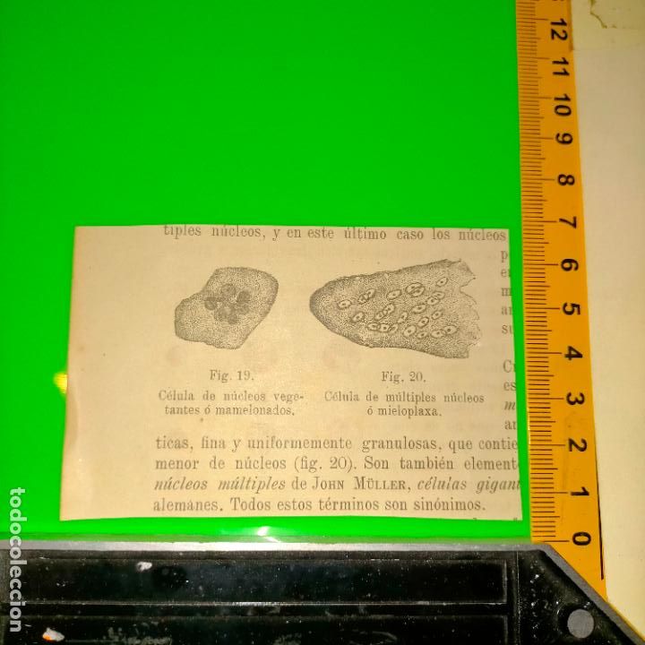 Libri antichi: antiguo grabado cuerpo humano medicina a&ntilde;o 1900 medico - PARTES ANATOMIA DISECCION VER FOTOS
