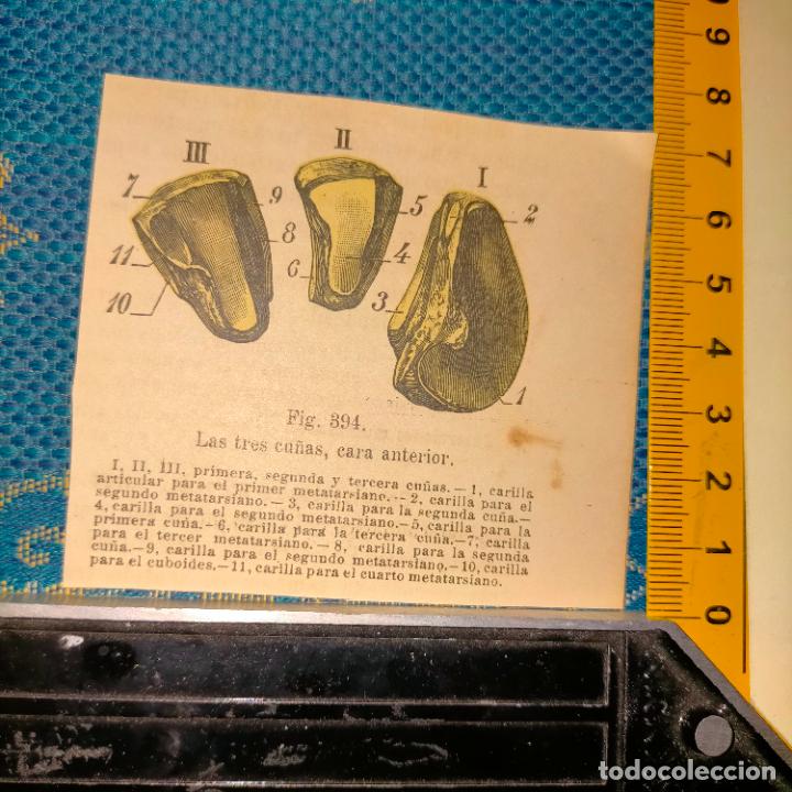 Antiquarische B&uuml;cher: antiguo grabado cuerpo humano medicina a&ntilde;o 1900 medico - PARTES ANATOMIA DISECCION VER FOTOS