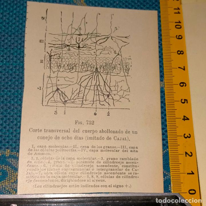 Antiquarische B&uuml;cher: antiguo grabado cuerpo humano medicina a&ntilde;o 1900 medico - PARTES ANATOMIA DISECCION VER FOTOS