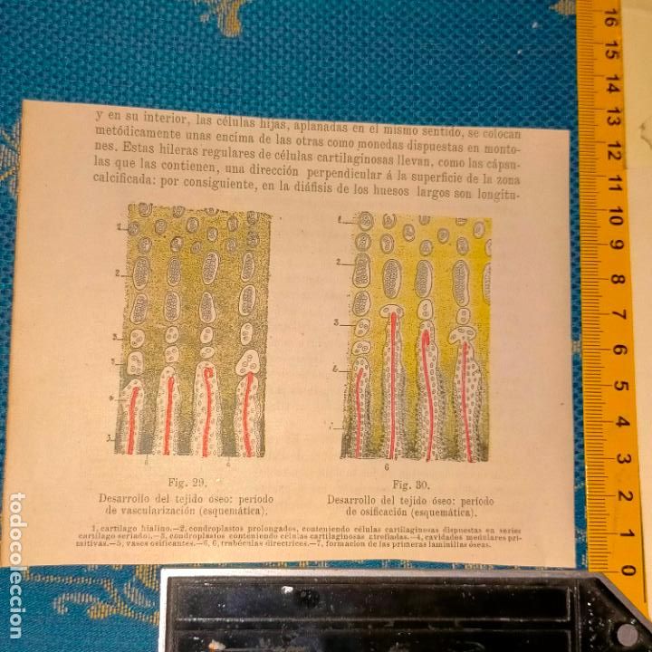 Antiquarische B&uuml;cher: antiguo grabado cuerpo humano medicina a&ntilde;o 1900 medico - PARTES ANATOMIA DISECCION VER FOTOS