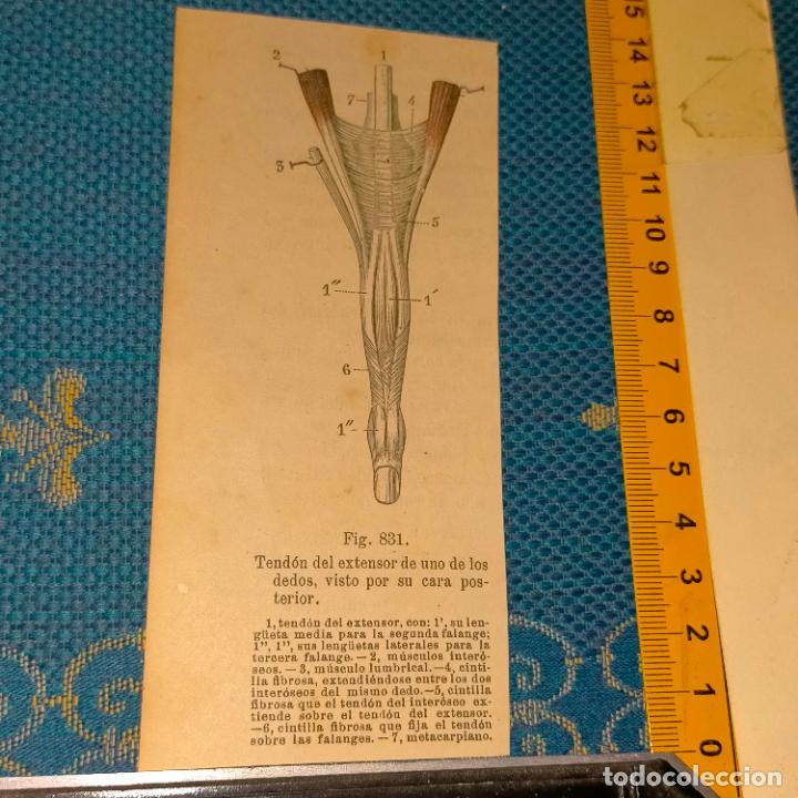Antiquarische B&uuml;cher: antiguo grabado cuerpo humano medicina a&ntilde;o 1900 medico - PARTES ANATOMIA DISECCION VER FOTOS