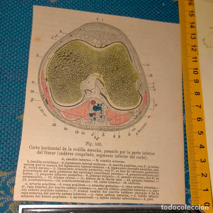 Antiquarische B&uuml;cher: antiguo grabado cuerpo humano medicina a&ntilde;o 1900 medico - PARTES ANATOMIA DISECCION VER FOTOS