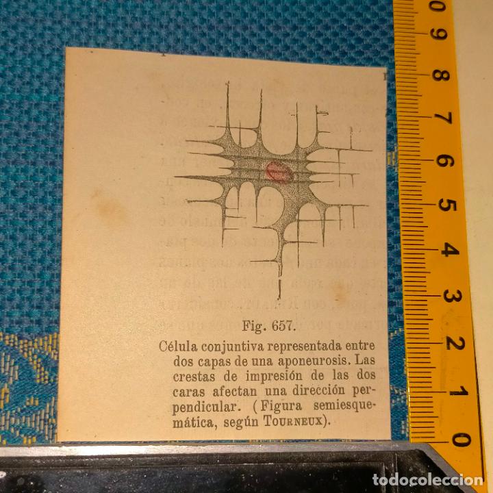 Antiquarische B&uuml;cher: antiguo grabado cuerpo humano medicina a&ntilde;o 1900 medico - PARTES ANATOMIA DISECCION VER FOTOS