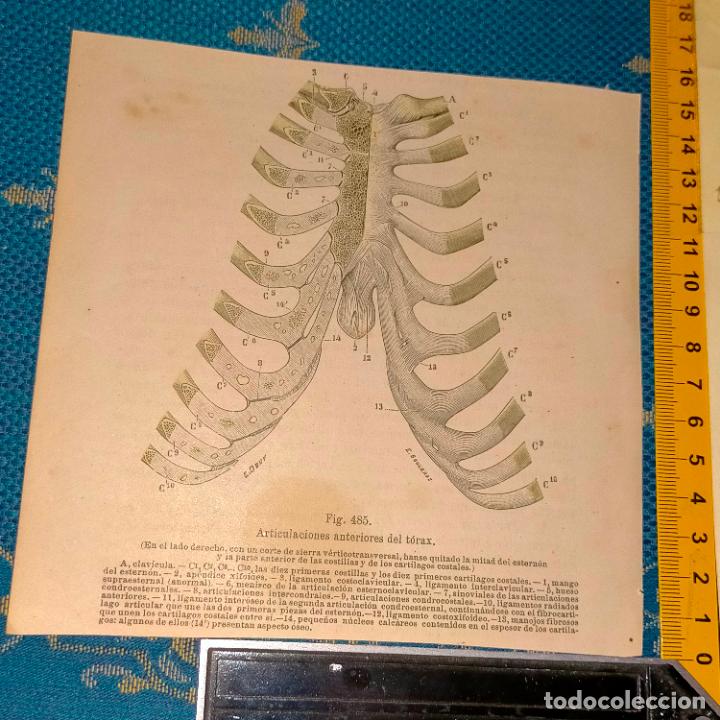 Antiquarische B&uuml;cher: antiguo grabado cuerpo humano medicina a&ntilde;o 1900 medico - PARTES ANATOMIA DISECCION VER FOTOS