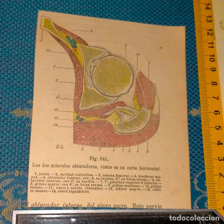 Libri antichi: antiguo grabado cuerpo humano medicina a&ntilde;o 1900 medico - PARTES ANATOMIA DISECCION VER FOTOS