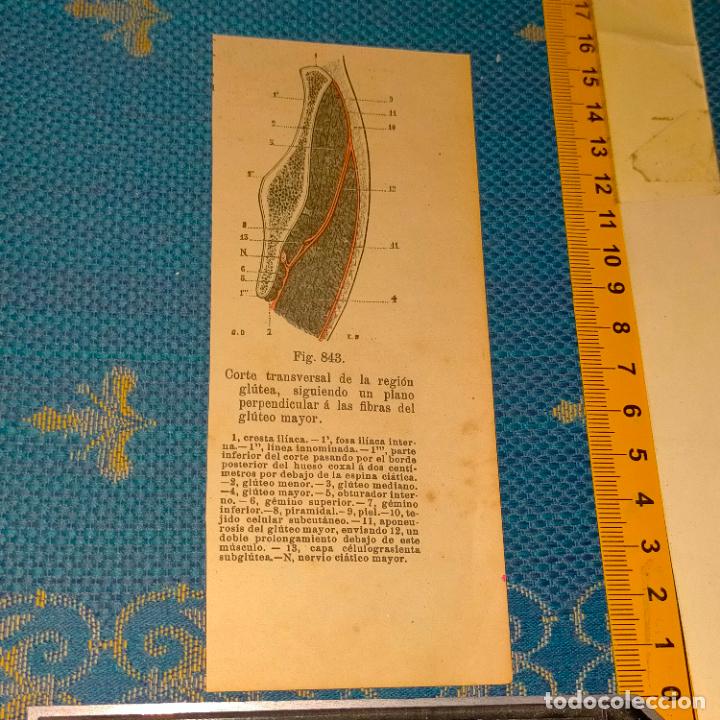 Libri antichi: antiguo grabado cuerpo humano medicina a&ntilde;o 1900 medico - PARTES ANATOMIA DISECCION VER FOTOS