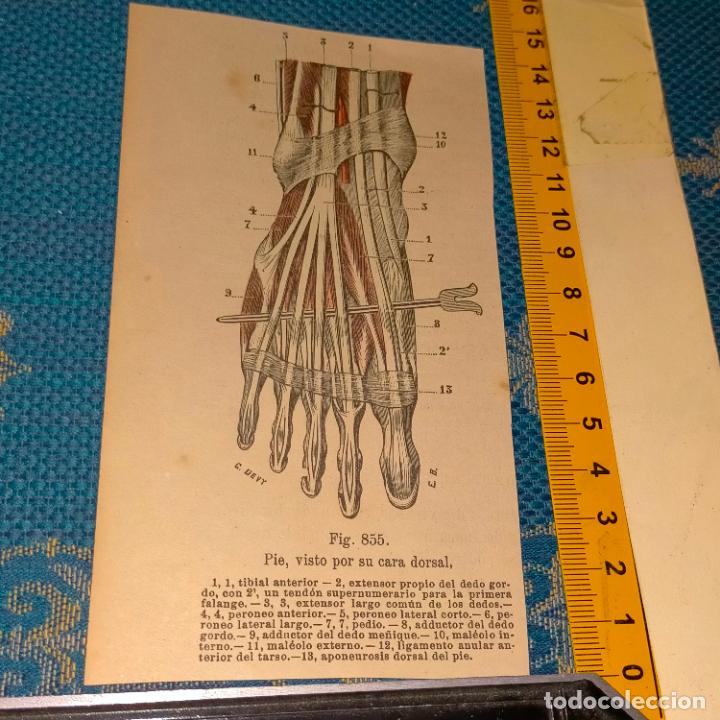 Antiquarische B&uuml;cher: antiguo grabado cuerpo humano medicina a&ntilde;o 1900 medico - PARTES ANATOMIA DISECCION VER FOTOS