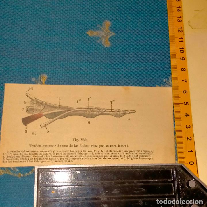 Antiquarische B&uuml;cher: antiguo grabado cuerpo humano medicina a&ntilde;o 1900 medico - PARTES ANATOMIA DISECCION VER FOTOS